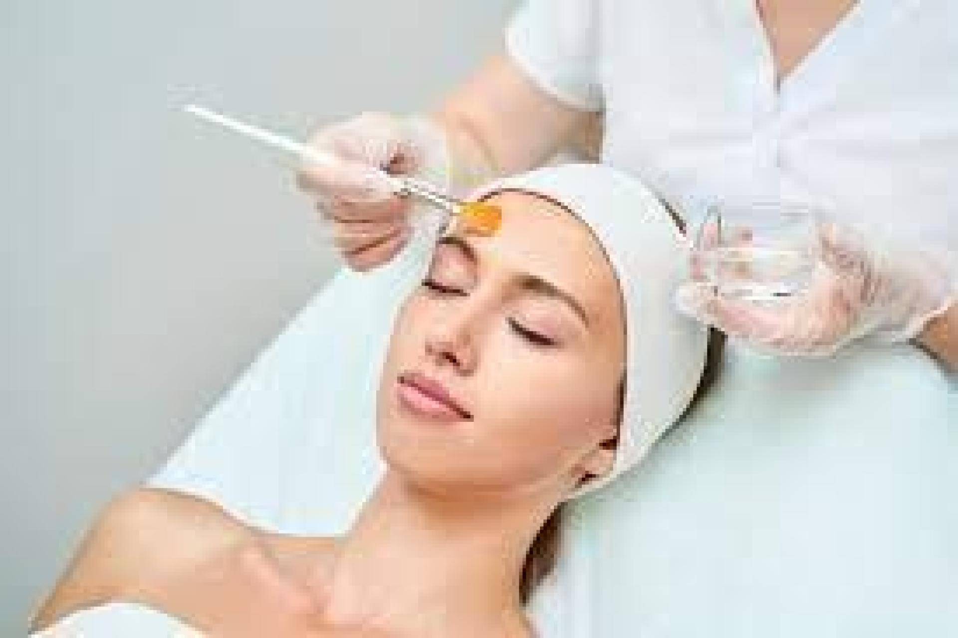 Trattamento medicina estetica Peeling Giulio Lotti Medico Chirurco estetico