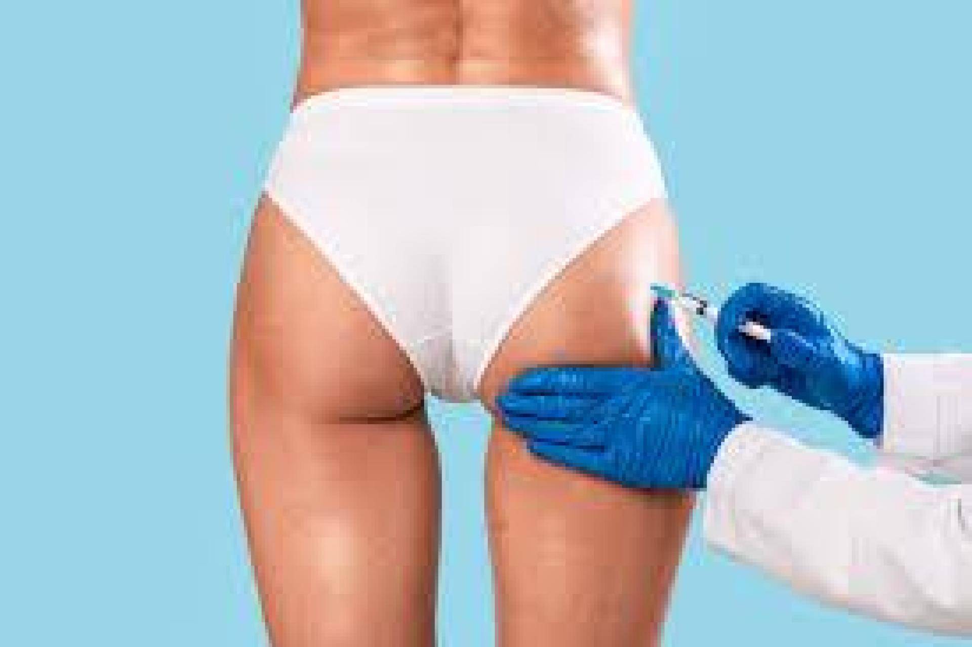 Trattamento medicina estetica Rimodellamento Glutei con Filler Giulio Lotti Medico Chirurco estetico